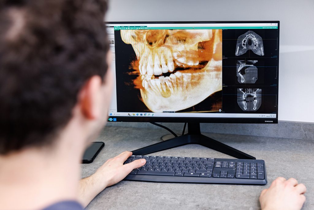 Dr. Varajti Artúr, az Artdent Fogászat vezető fogorvosa fogászati CT (CBCT) felvételt néz