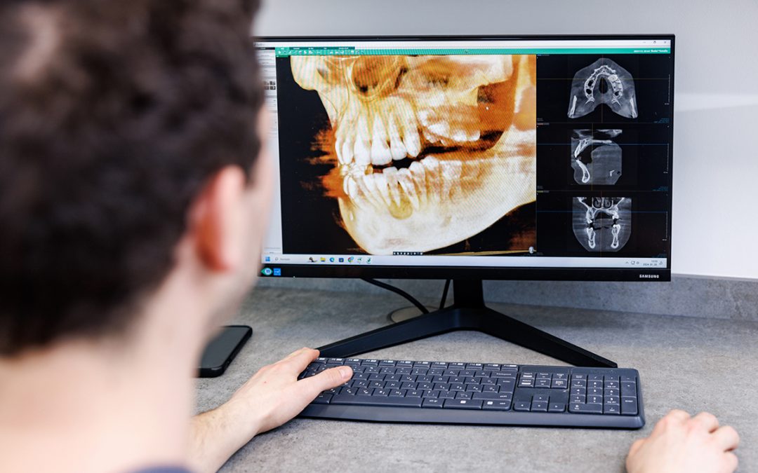 Fogászati CT-felvétel (CBCT-felvétel)